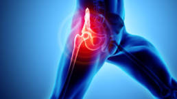 Hip Joint Pain Treatment