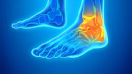 Manage Foot and Ankle Pain